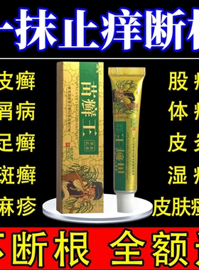 苗癣王草本乳膏皮癣药膏外用正品杀菌皮肤湿疹止痒去根苗医药膏