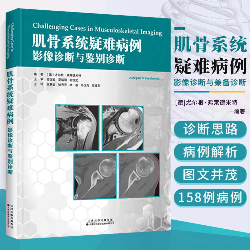肌骨系统疑难病例 影像诊断与鉴别诊断 尤尔根弗莱德米特 郑建军 如何选择正确的影像学检查方法 肌骨系统疑难病例的影像诊断思路