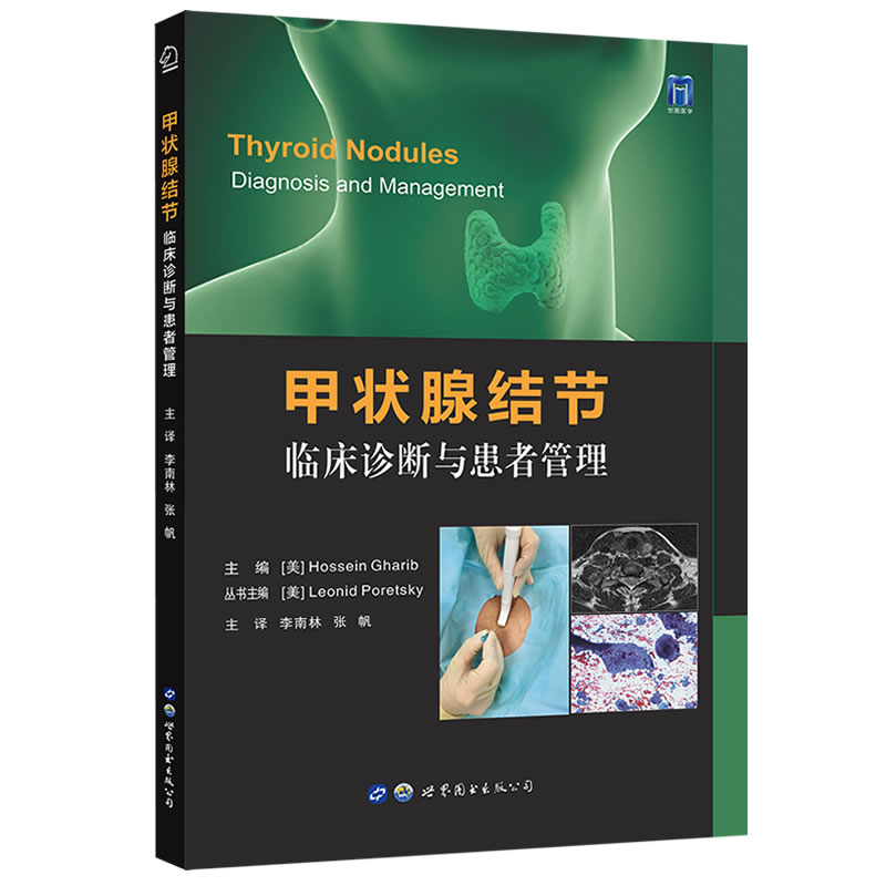 甲状腺结节临床诊断与患者管理