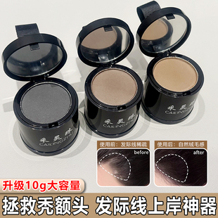 10g发际线遮盖粉防水防汗头发稀少填充神器修饰大额头自然高马尾