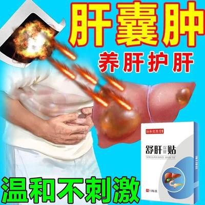 肝囊肿治疗正品的药养肝护肝神器消除肾多发性舒肝专用贴消囊克星