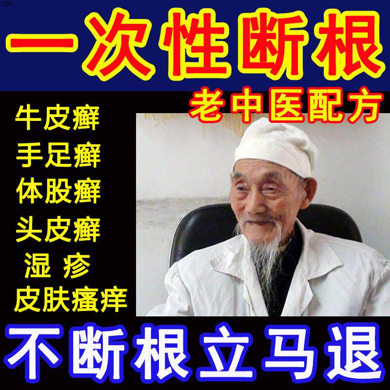 牛皮癣银屑癣藓皮肤瘙痒外用药手足藓体股藓真菌感染止痒特效药膏