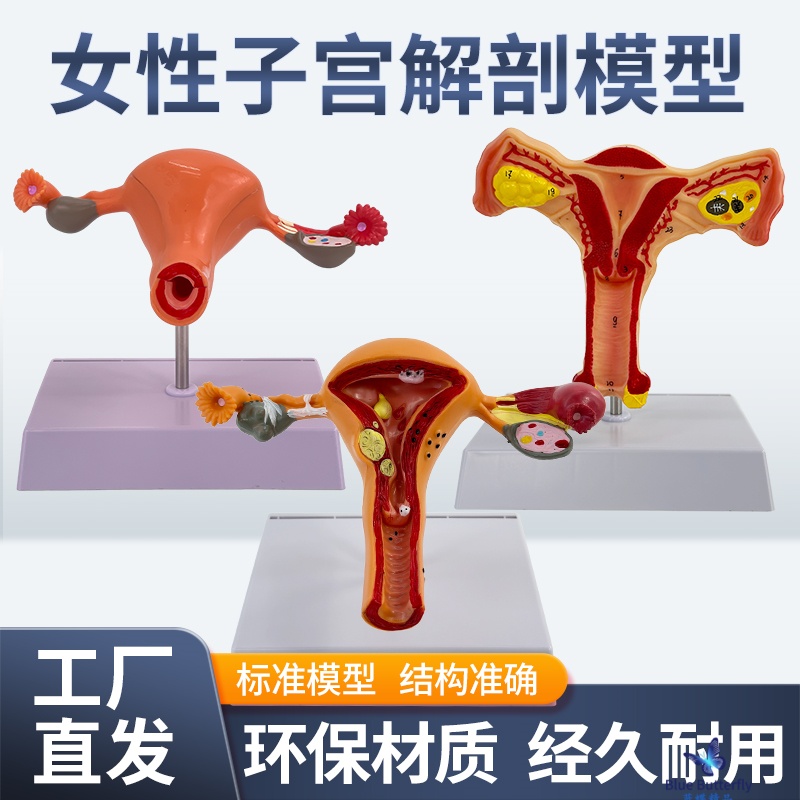 仿真病理子宫输卵管解剖蓝蝶教学