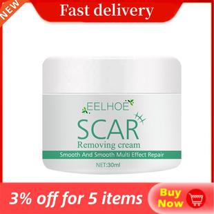Removal Scar Cream Face Pimples Scar Stretch Marks Removal A