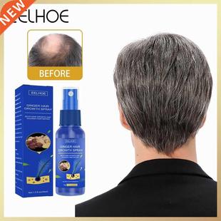 Hair Growth Spray Products Biotin Fast Grow Hair Oil Growth