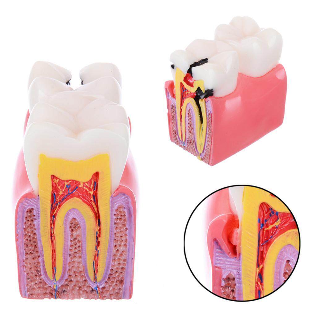 Modèle de dents d	éducation d	anatomie d