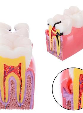 Modèle de dents d	éducation d	anatomie d