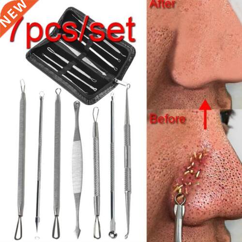 3-8Pcs Blackhead Acne Pimple Remover Needle Stainless Steel
