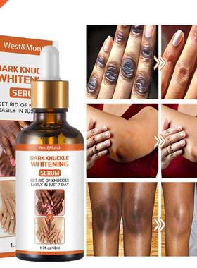 Joint De-blackening Beauty Serum Lighten Melanin Knee Ankle