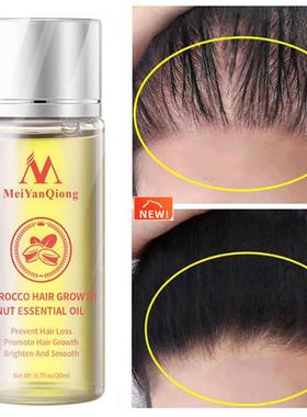 Moroccan Hair Growth Essential Oil Products Anti Hair Loss T