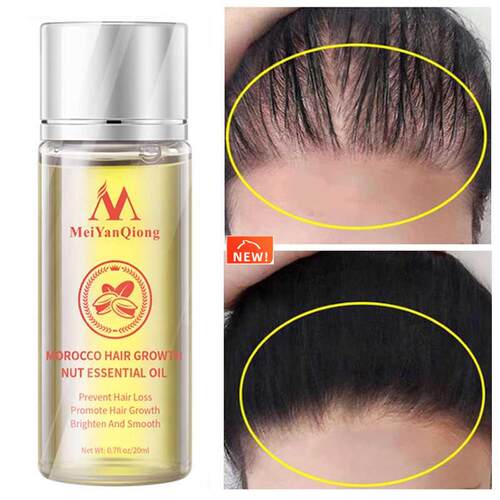 Moroccan Hair Growth Essential Oil Products Anti Hair Loss T