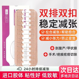 隆畅医用拉链式减张器甲状腺剖腹产术后伤口愈合贴免缝疤痕减张贴