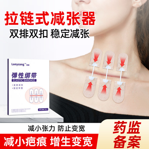 【甲状腺术后减张】隆畅医用疤痕减张器术后愈合皮肤伤口减张贴