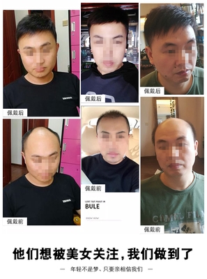 高档假发男士补发片男假发短发帅真发气发块头顶无痕补发片隐形补