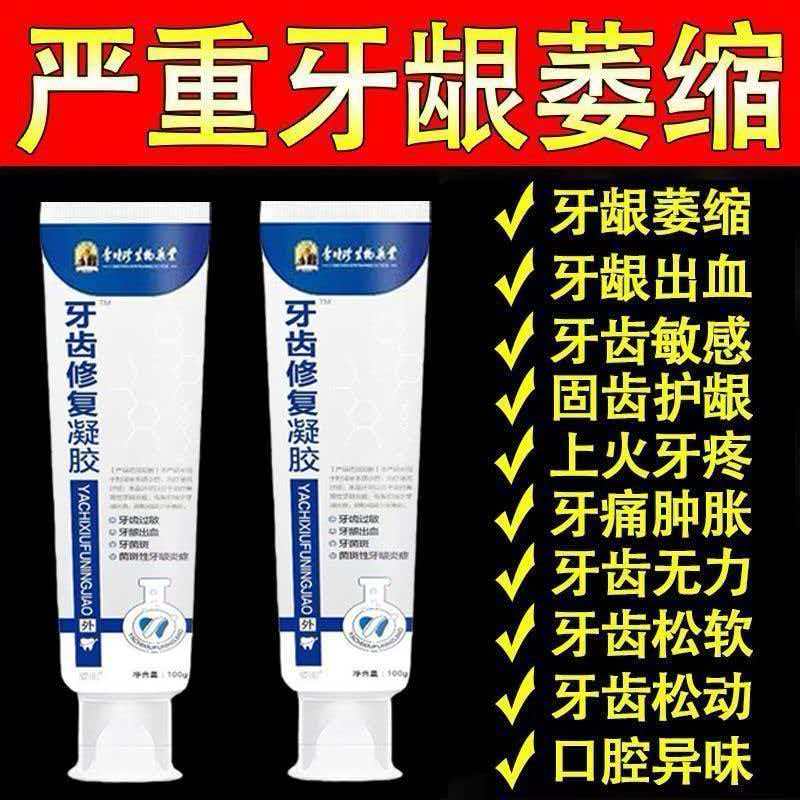 李时珍牙齿修复凝胶牙科分离剂牙龈萎缩牙齿松动牙龈出血固齿培龈