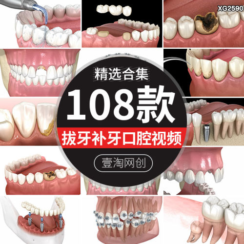 拔牙补牙洗牙清洗口腔镶牙种植假牙齿矫正医疗牙科3D动画影片素材