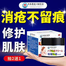 日本玫瑰痤疮药膏修复重度祛痘印膏去闭口粉刺暗疮屏障受损专用