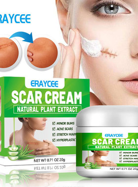 ERAYCEE 跨境天然芦荟淡疤 痘印烧伤 手术疤 剖宫产疤 护理霜