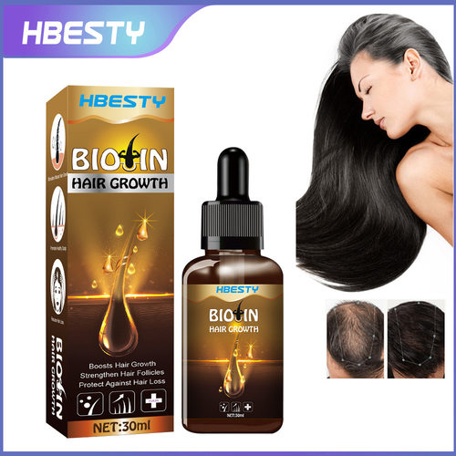 HBESTY 跨境密发油 迷迭香生姜草本精华防掉护发头皮滋养精油