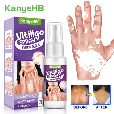 KanyeHB 白斑净 汗斑白斑花斑皮肤外用喷剂 跨境亚马逊Wish