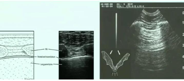 重症超声教学视频教程理论实操培训班讲解课程心脏肺部肾脏B超