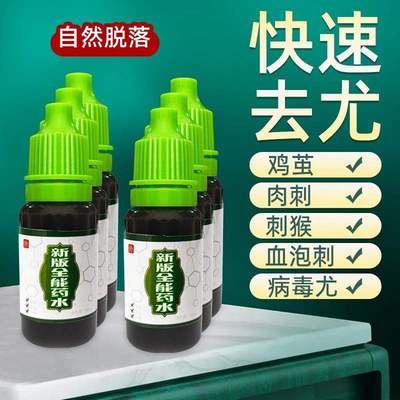 新版全能门店药水鸡眼肉刺刺猴老茧等结痂自然脱落无需包扎