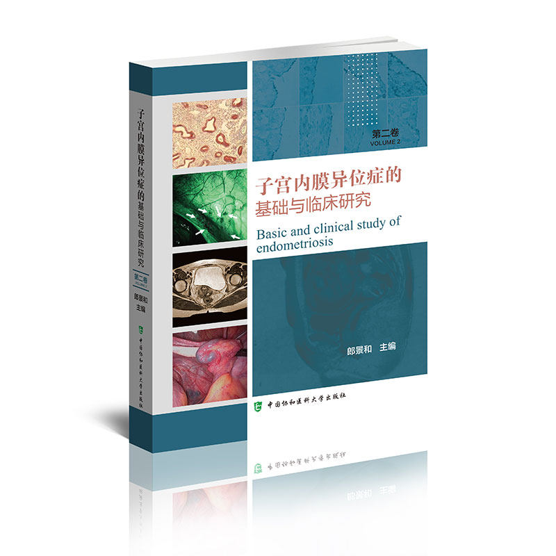 现货子宫内膜异位症的基础与临床研究第二卷郎景和教授主编中国协和医科大学出版社9787567915732