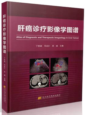 正版现货 肝癌诊疗影像学图谱(精装彩图)丁世斌 司永仁 吴威/主编 辽宁科学技术出版社