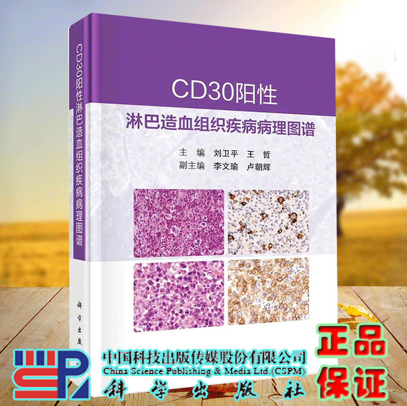 现货正版 CD30阳性淋巴造血组织疾病病理图谱 收集62例表达CD30的淋巴组织肿瘤和淋巴组织增生性疾病病例科学出版社9787030718358