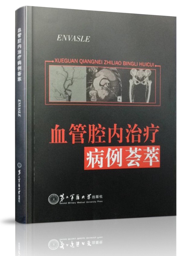 血管腔内治疗病例荟萃