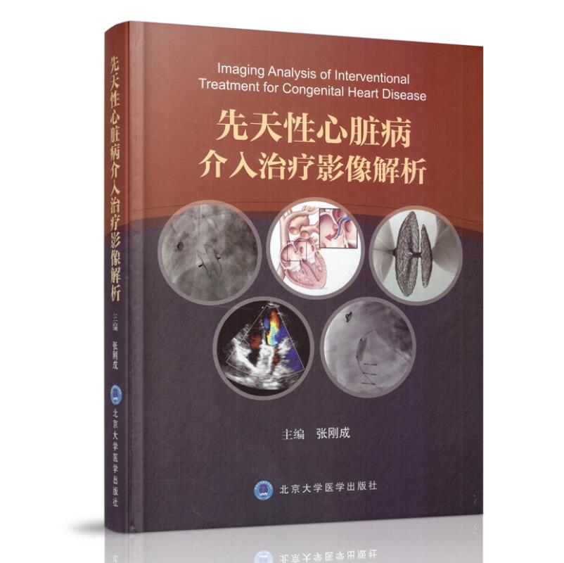 正版现货 先天性心脏病介入治疗影像解析 张刚成,主编 北京大学医学出版社