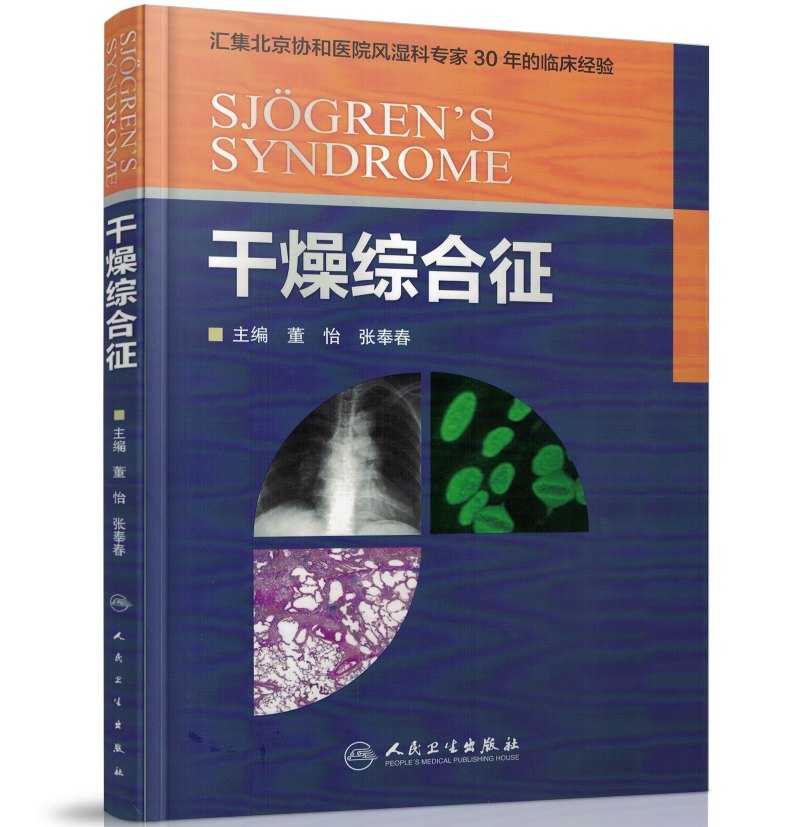 正版现货 干燥综合征(部分彩图)·汇集北京协和医院风湿科专家30年的临床经验 董怡 张奉春/主编 人民卫生出版社