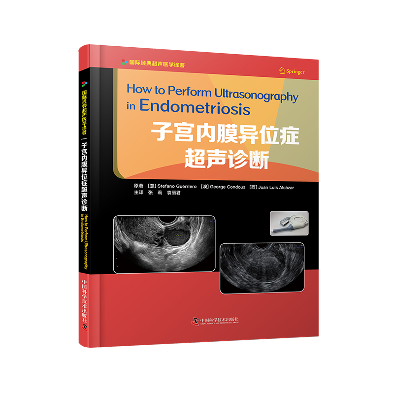 现货 子宫内膜异位症超声诊断 国际经典超声医学译著 张莉 袁丽君 中国科学技术出版社 书籍/杂志/报纸 影像医学 原图主图