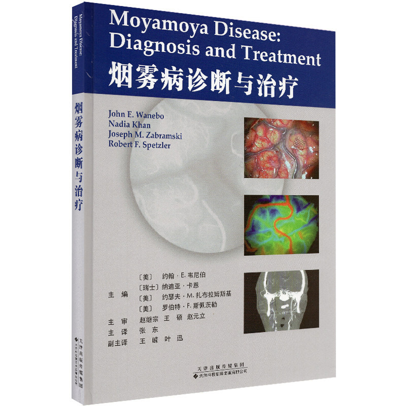 现货 烟雾病诊断与治疗[美]约翰·E·韦尼伯[瑞士]纳迪娅·卡恩 天津科技翻译出版社