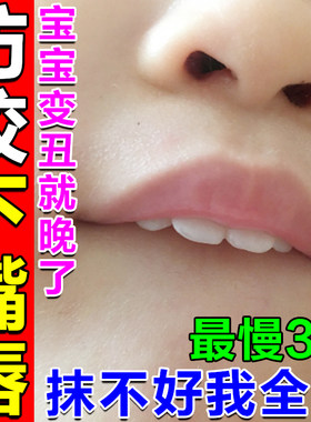 婴儿宝宝治疗咬嘴唇专用神器禁咬