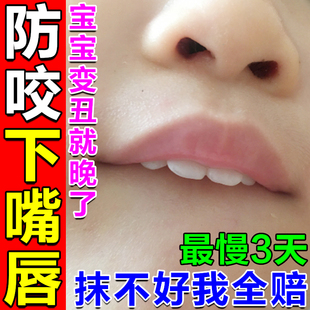 防咬下嘴唇神器小孩矫正器防止宝宝口呼吸儿童凸嘴舔吸手指苦瓜水
