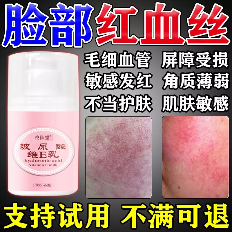 去红血丝修复角质层改善敏感肌肤增厚修护大红脸部泛红敏感肌膏