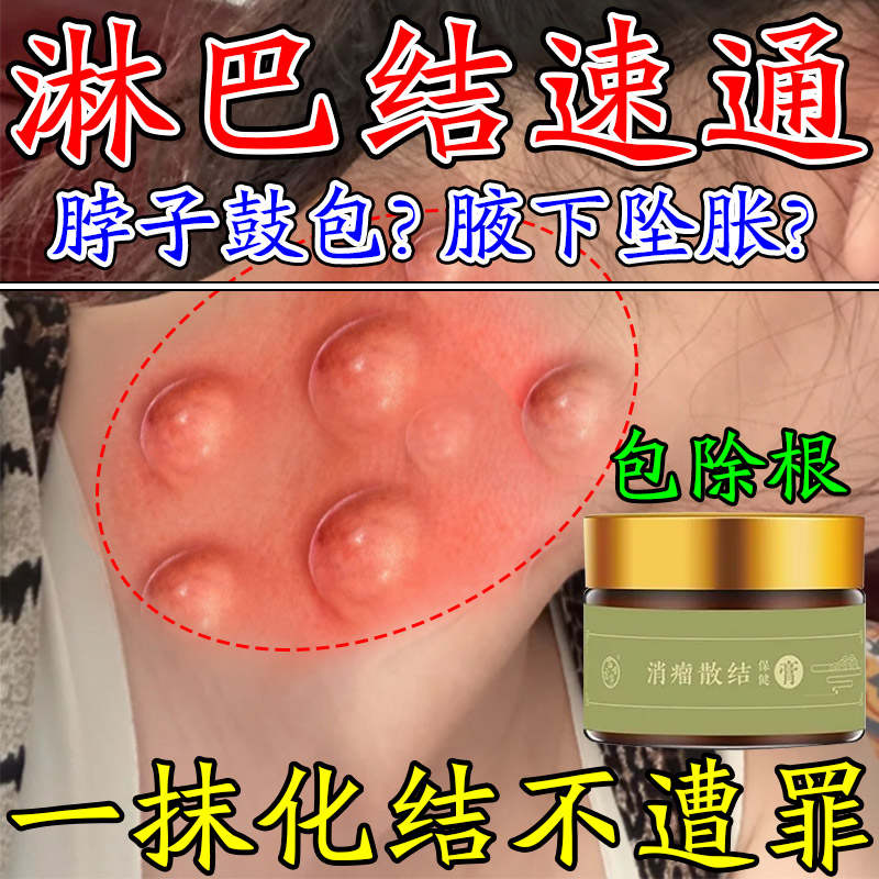 【一抹消】淋巴结消散膏治愈万人