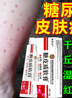 糖尿病老年人皮肤痒专用止痒膏药