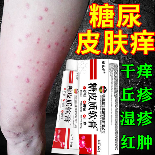 糖尿病老年人皮肤痒专用止痒膏药