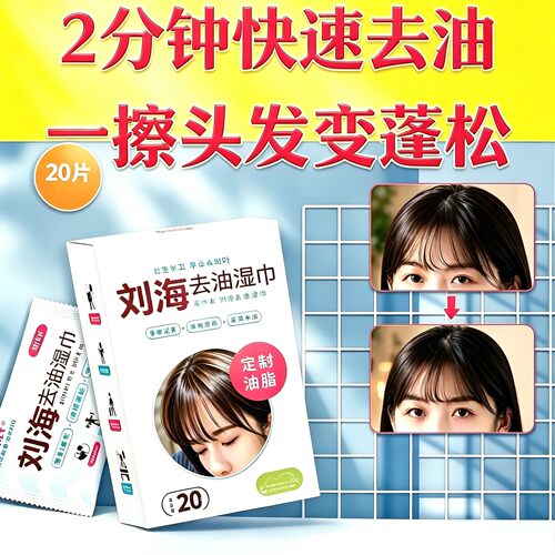 刘海去油湿巾免洗清洁除汗味