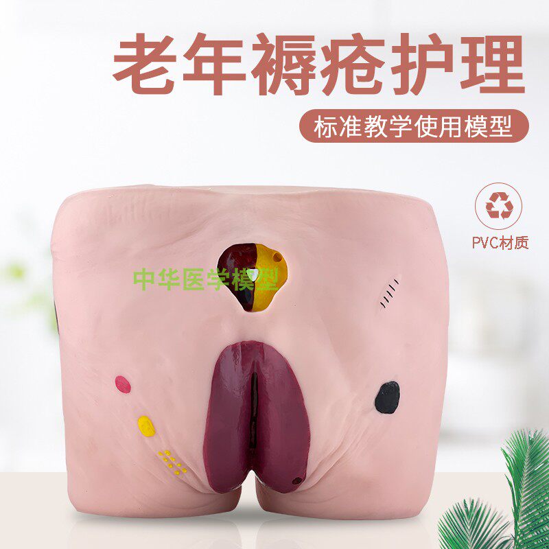 中华模型压疮(褥疮)护理模型