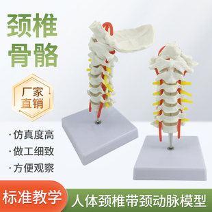 人体颈椎带颈动脉后枕骨、椎间盘与神经模型 自然大颈椎模型