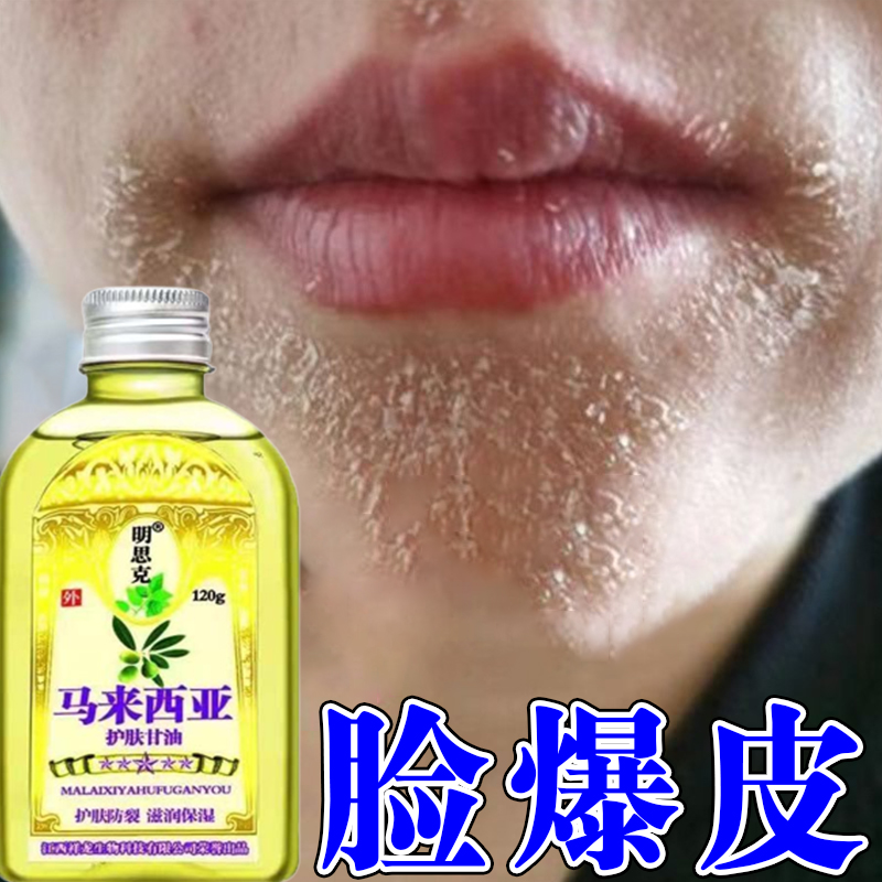 脸上起皮干燥脸干掉皮脸部干皮起皮干痒冬天皮肤干燥脱皮护肤甘油