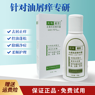 大有丽影去屑止痒洗发水控油抗真菌洗发精华露头皮屑丽影官方正品
