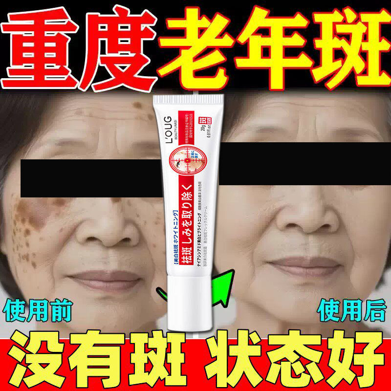 祛斑霜老年斑脸部手上手部手背斑改善暗黄淡化细纹嫩白肌肤正品