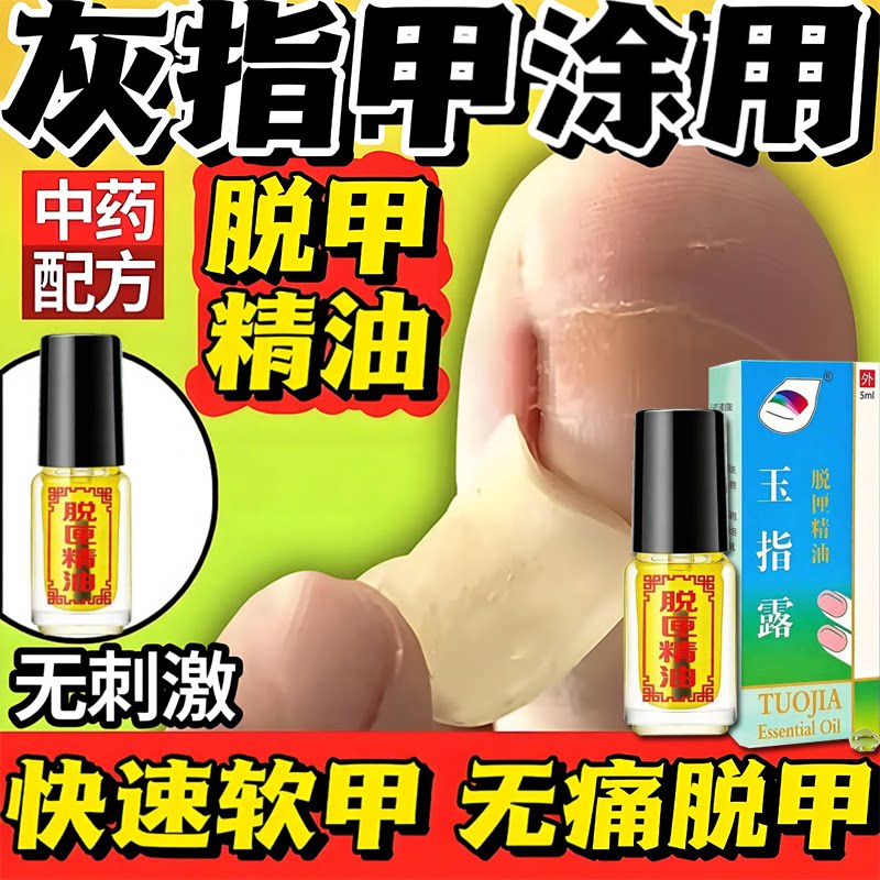 灰指甲脱甲精油甲沟焱足部护理软甲液灰甲清无痛脱甲坏甲正品