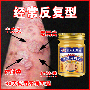 牛痒膏银痒皮榍红痒疙瘩草本乳膏皮肤搔痒全身干痒手足痒外用