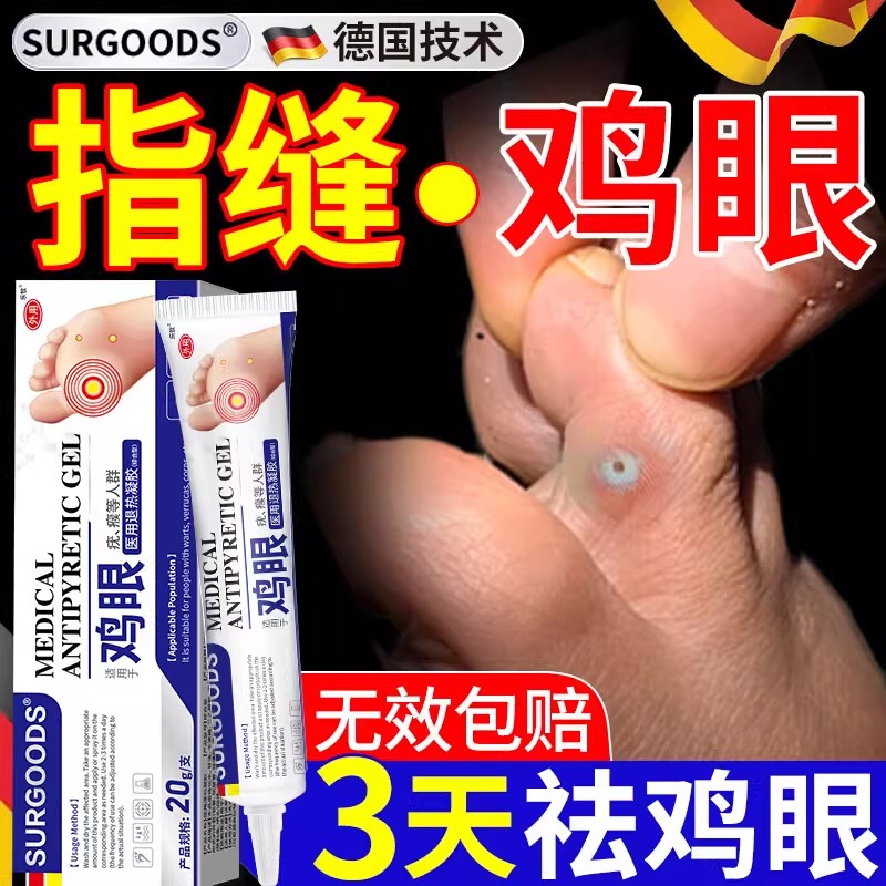 鸡眼膏脚底长跖疣去除脚钉瘊子肉粒挖鸡眼贴老茧一抹灵专用膏xl