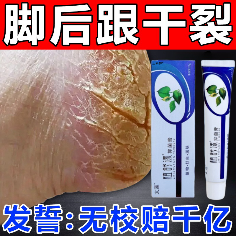 太莲植舒漾抑菌膏手足皲裂脱皮膏皴脚足后跟防裂膏防开手足干裂ek
